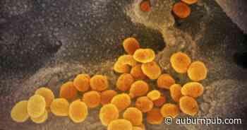 NY database down, affects Cayuga County COVID-19 contact tracing - The Citizen