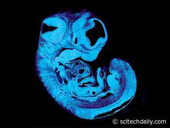 “Battle of the Sexes”’ Begins in Womb – Father’s and Mother’s Genes Tussle Over Nutrition