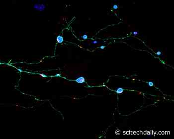 How Toxic Aggregates Form and Kill Brain Cells in Prion Diseases