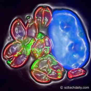 Scientists Discover How Toxoplasma Parasites in the Brain Manipulate Host Cells To Survive