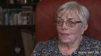 Ulm: Gesicht entstellt vom eigenen Hund - SWR