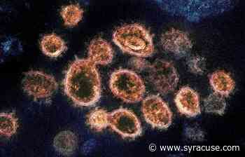 What is flurona? What are symptoms of flu + coronavirus co-infection? How serious is it? - syracuse.com