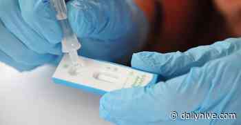 Where to get a COVID-19 rapid test in Calgary | News - Daily Hive