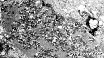 US rabies deaths last year were highest in a decade