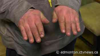 Edmonton officials defend policy to kick people out of LRT station during brutal cold - CTV News Edmonton