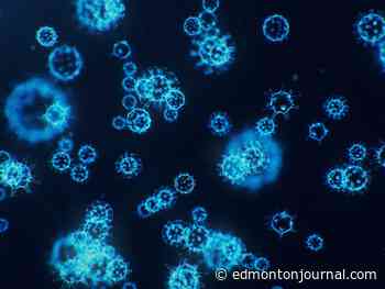 COVID-19: Alberta reports 6,257 new cases, more than 500 hospitalizations
