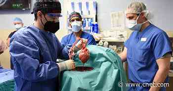 Surgeons transplant pig's heart into human for first time     - CNET