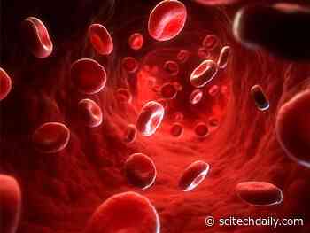 Pathogenic Particles in Blood Identified With New Technique