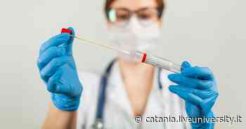 Catania, tamponi gratis per studenti nelle farmacie: come ottenerli - Liveunict | Magazine sull'Università di Catania