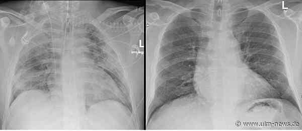 Gebündelte Daten zur Erforschung von COVID-19