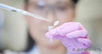 New UCalgary drug study shows promising treatment option for MS patients