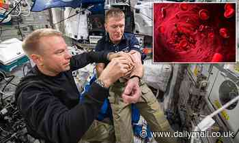 Astronauts suffer from anemia in space because their bodies destroy a MILLION more red blood cells