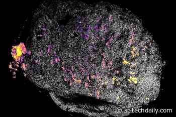 Enhancing Cancer Immunotherapy: New Method for Delivering Immune System-Stimulating Drugs