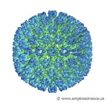 Study: More evidence links a virus to multiple sclerosis - Virden Empire Advance