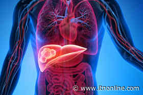 ASTRO Issues Clinical Guideline on External Beam Radiation Therapy for Primary Liver Cancers - Imaging Technology News