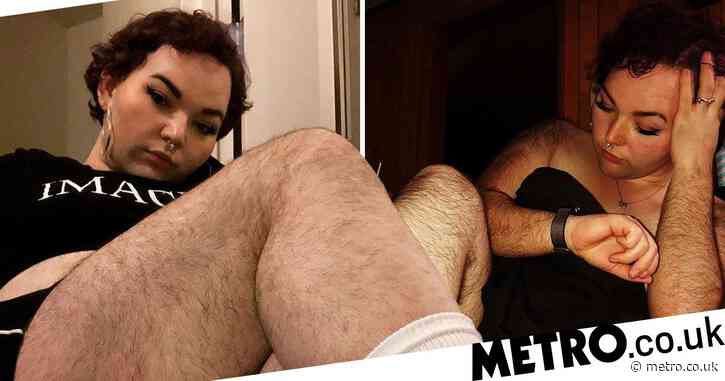 Woman with condition that causes excess hair growth called ‘Chewbacca’ by school bullies