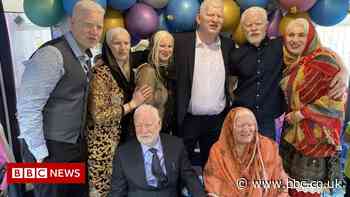 Albinism: Coventry family embraces Guinness World Record - BBC News