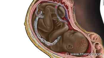 Aspiring Neurosurgeon to Have his Medical Illustrations Showing Black People Published - The Root