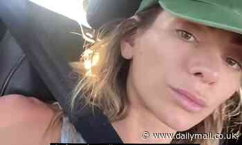 Makeup free Nadia Bartel reveals she has acne and shows off the 'sore skin pimples' on her face