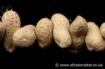 Study examines peanut allergy treatment for children - St Helens Star