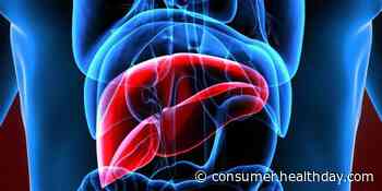 Guideline Issued for External Beam RT in Primary Liver Cancers - HealthDay News