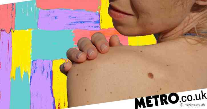 A guide to understanding moles – and knowing when to worry about them