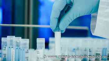 Gesundheitsminister: In vielen Fällen kein PCR-Test mehr