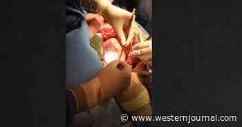 Doctors' Experimental Hail Mary Procedure Saves Patient: 'We Are Trying to Make Sense of It'