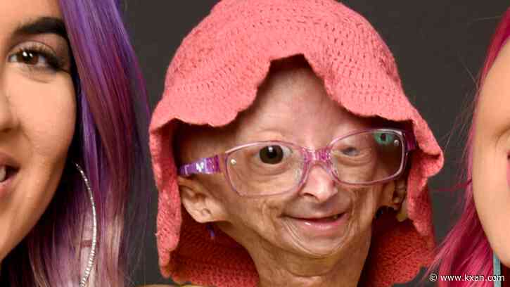 Family, friends honor Austin-based social media star Adalia Rose's legacy at memorial service