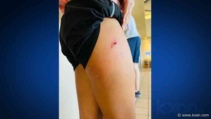 Teravista neighbors say den of coyotes attacking pets, children