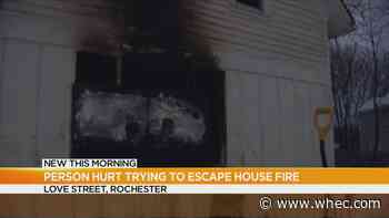 Two escape, one person hurt in Love Street house fire