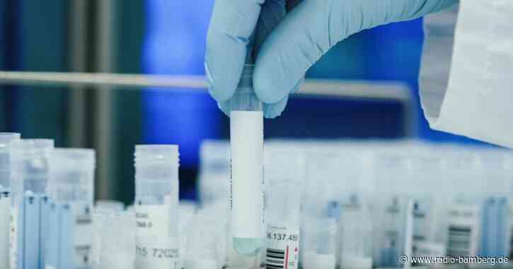 Laborverband: Jeder dritte Test positiv