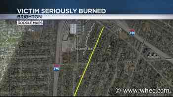 Brighton Police: 88-year-old woman seriously burned