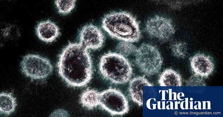 Long Covid: doctors find ‘antibody signature’ for patients most at risk