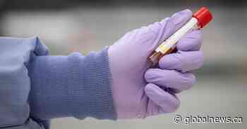 DynaLIFE signs contract with AHS to deliver community lab services across Alberta