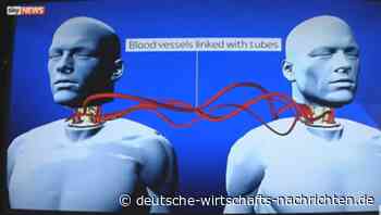 Kopf-Transplantation: Neurologen wahnsinnig oder hochintelligent?