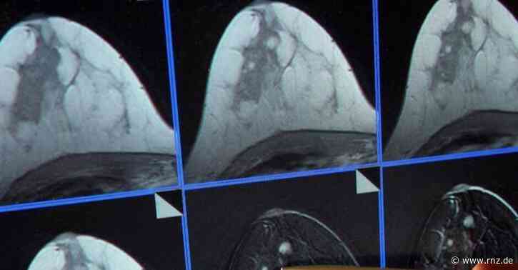 DKFZ Heidelberg:  Corona bremst Krebsfrüherkennung und Nachsorge aus