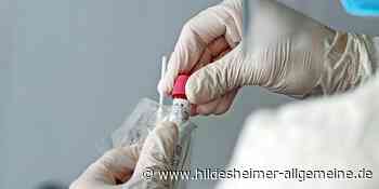 Landkreis Hildesheim meldet 935 neue Corona-Infektionen über das Wochenende - www.hildesheimer-allgemeine.de