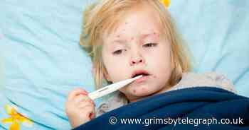 Deadly measles warning to parents as vaccination drops dangerously low - Grimsby Live