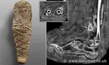 Scientists find four-year-old mummy buried in Egypt 2,000 years ago had a dressed, pus-filled wound