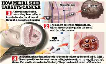 Magnetic balls that heat up and then blast away tumours
