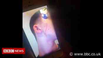 East Yorkshire family claims son assaulted at Bolton autism centre - BBC News