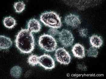 Unexplained 'cryptic lineages' of coronavirus found in New York City sewage. Is it the rats? - Calgary Herald
