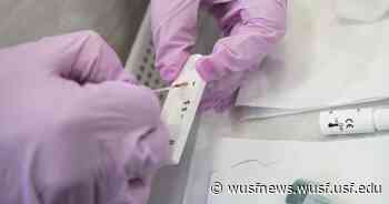 Coronavirus FAQ: My drugstore now offers antibody tests. Is it worth getting one? - WUSF News