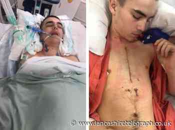 Blackburn mum's disgust at sentence for teen who stabbed her son in chest
