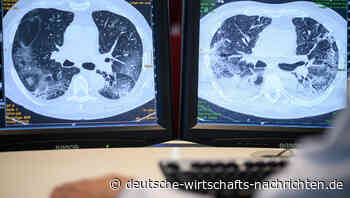 Ausländer in Russland müssen sich alle 3 Monate röntgen lassen