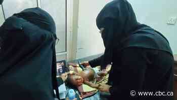 Cut off by COVID and conflict, Canadian medical mission to Yemen goes virtual