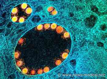 Detection of SARS-CoV-2 Delta variant infection in a domestic cat - News-Medical.Net