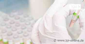 Worum handelt es sich bei der Omikron-Variante BA.2?