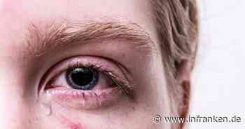 Bamberg: Jugendliche gehen auf jüngere Kinder los - Streit an Skateranlage artet aus